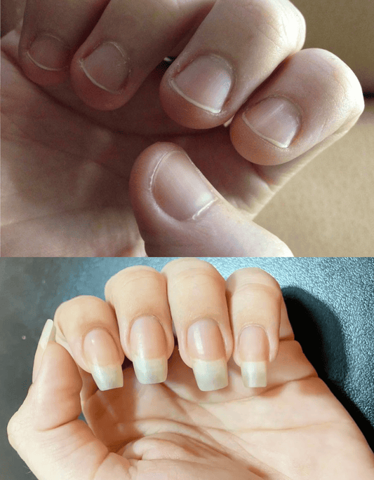 💅 LLEVATE 3 ENDURECEDORES AL PRECIO DE 1 💅  Recupera tus uñas en 10 días